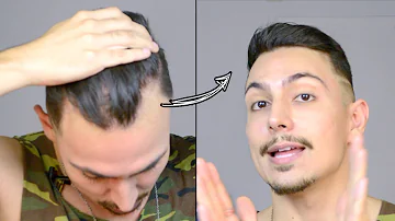 Como eliminar entradas no cabelo?