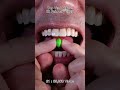 Satisfying Chewing ASMR #Compilation #ASMR #DoctorTristanPeh