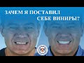 Зачем я поставил себе виниры? Академик Маланьин, рассказывает о своих ощущениях как пациента.