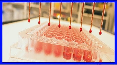 Breaking News | This new method for testing blood with sound waves is insanely clever