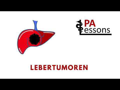 Podcast Chirurgie Lebertumoren / PA-Lessons