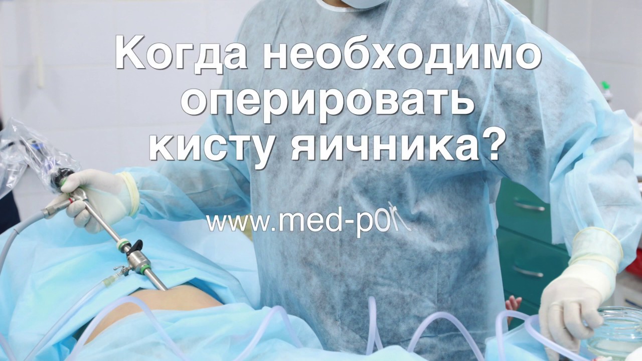Когда необходимо оперировать кисту яичника? - YouTube