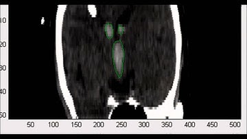 Probabilistic model for interactive 3D segmentation