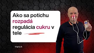 Prečo Vysoký Cukor Ničí Telo Skôr, Než Si To Všimnete