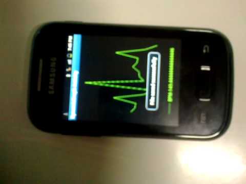 AABSyS Android ECG plot