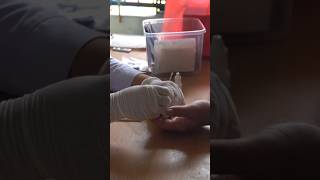 deteksi Dini Penularan HIV