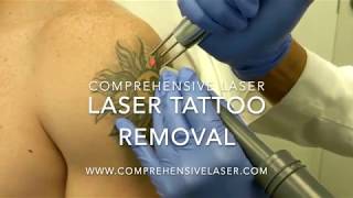 THE BEST 10 Tattoo Removal in Baltimore MD  Last Updated June 2023  Yelp