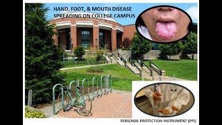 College Students seek vaccine alternatives.