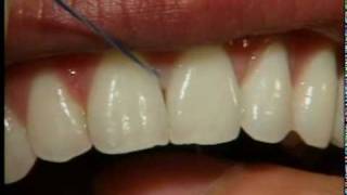 VID04_Flossing_Teeth_646_CARE.flv