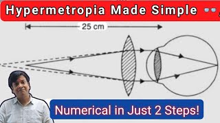 Hypermetropia Explained | Numerical on Nature & Power of Lens | Class 10 Science Human Eye