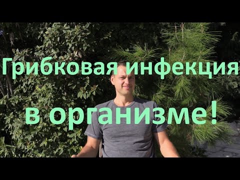 Грибковая инфекция (микозы) - причины, симптомы и лечение
