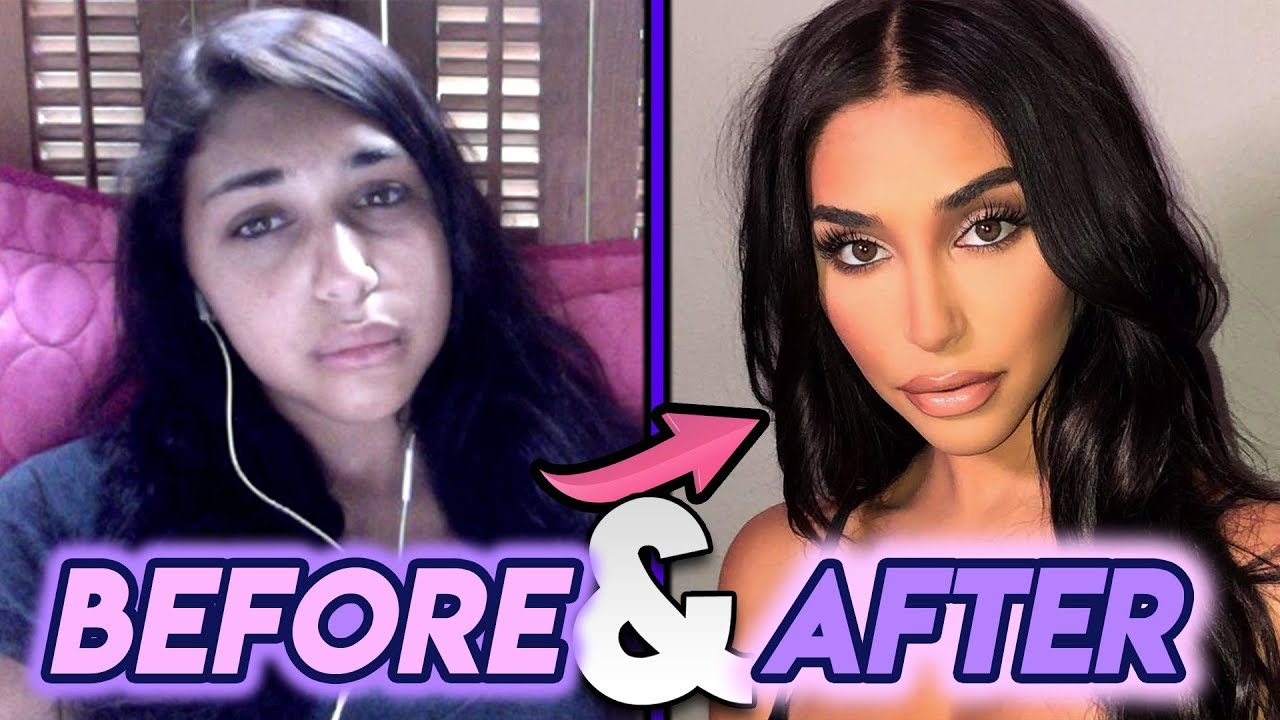 Chantel Jeffries Before and After Transformations Plastic Surgery Transform...