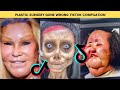 Plastic Surgery Gone Horribly Wrong 😭 | TikTok Compilation