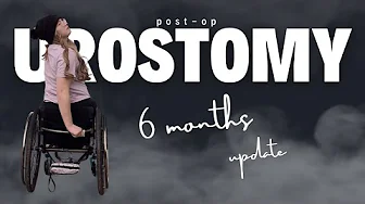 6 Months Post-Op Urostomy: Do I regret it?