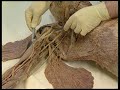 Dissection du corps humain commente  paule rgion axillaire et bras vue ventrale