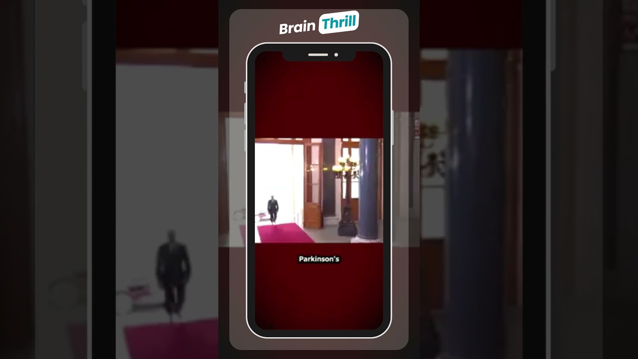 Putin walks normally.  