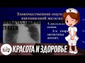 Злокачественные опухоли трахеи