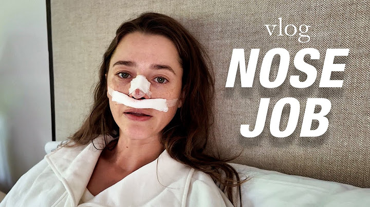 I Got A Nose Job | My Rhinoplasty Experience