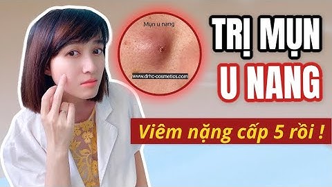 Cách xử lý mụn u