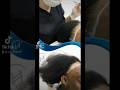Traction Alopecia / Afro Hairline Restoration in Turkey