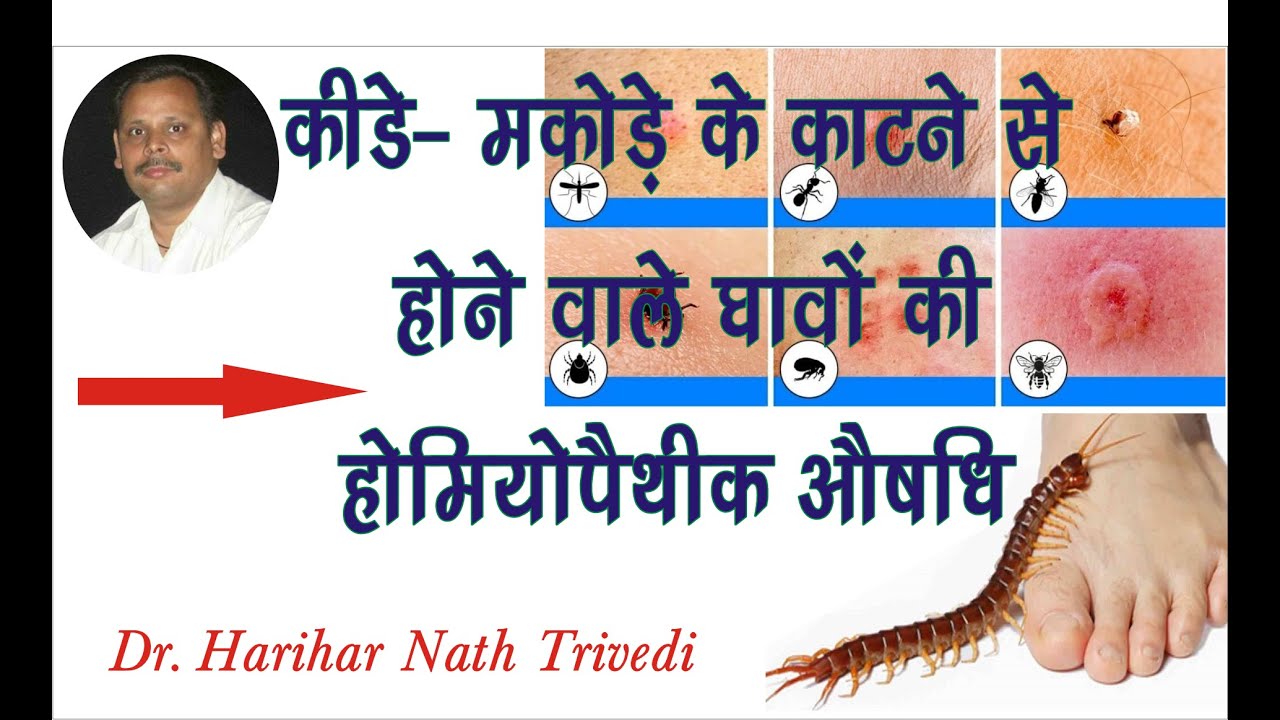 Homeopathic Medicine for insect bite, कीड़े मकोड़े के काटने से होने