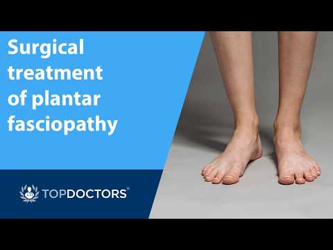  Surgical treatment of plantar fasciopathy