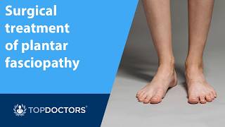 Surgical treatment of plantar fasciopathy