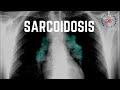 Sarcoidosis 101
