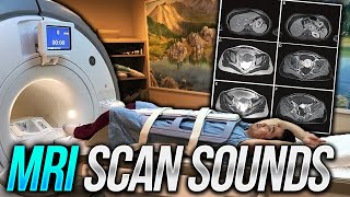 MRI Sounds Inside Scan Room - Pelvic MRI with Contrast ASMR