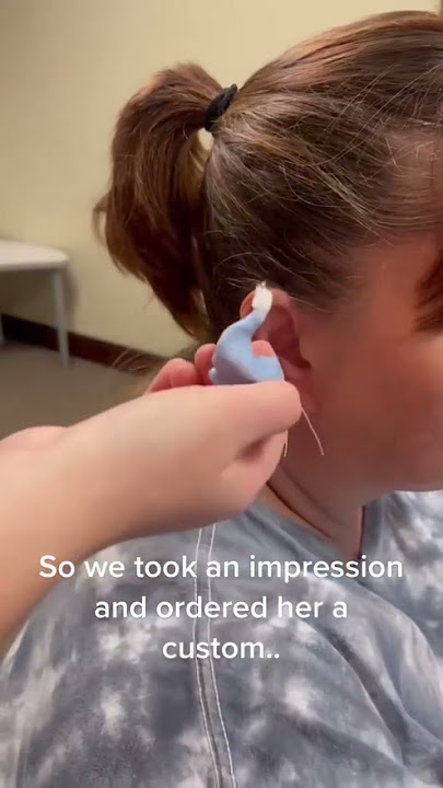 BTE hearing aid for this patient with profound hearing loss! #rochesterny #audiologist #rochester