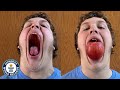 Me & my monster mouth gape! - Guinness World Records