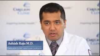 Be Heart Smart: What is Peripheral Artery Disease (PAD)?