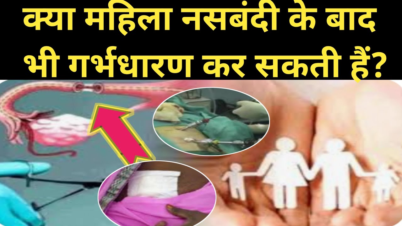 kya nasbandi ke baad bhi mahila pregnant ho sakti hai?Pregnancy