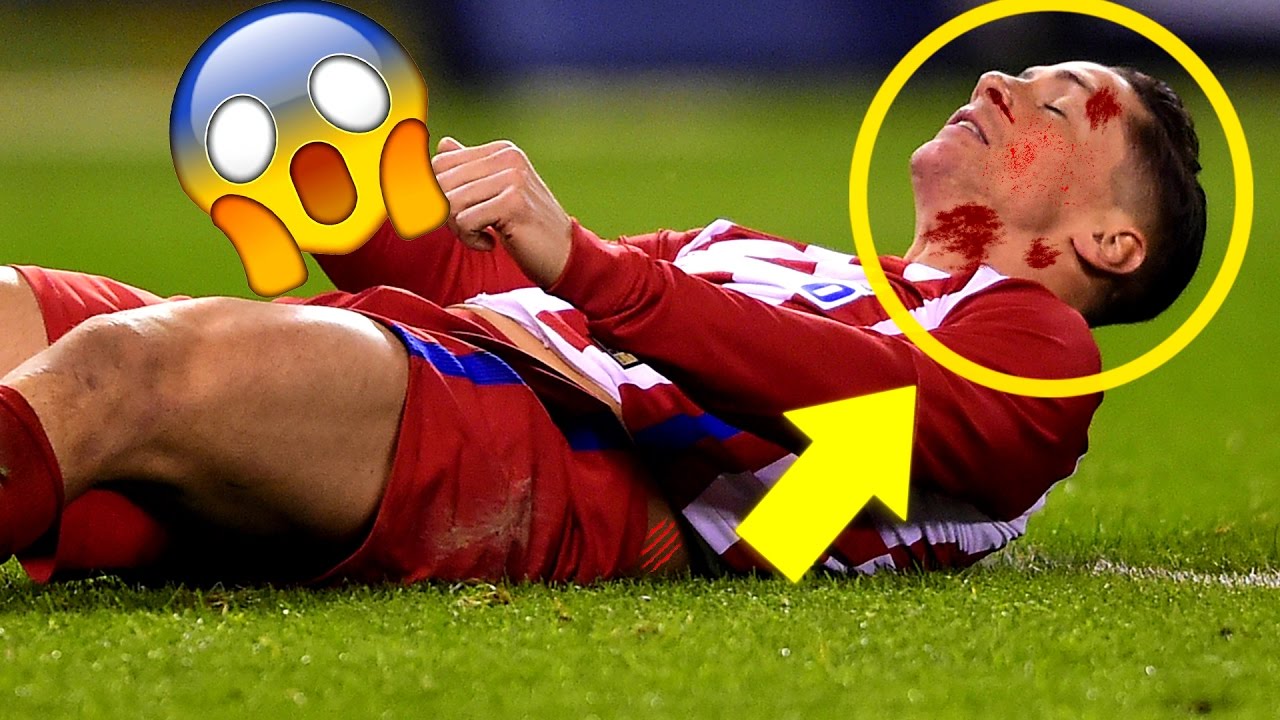 Horror Football Fouls & Tackles in 2017! YouTube