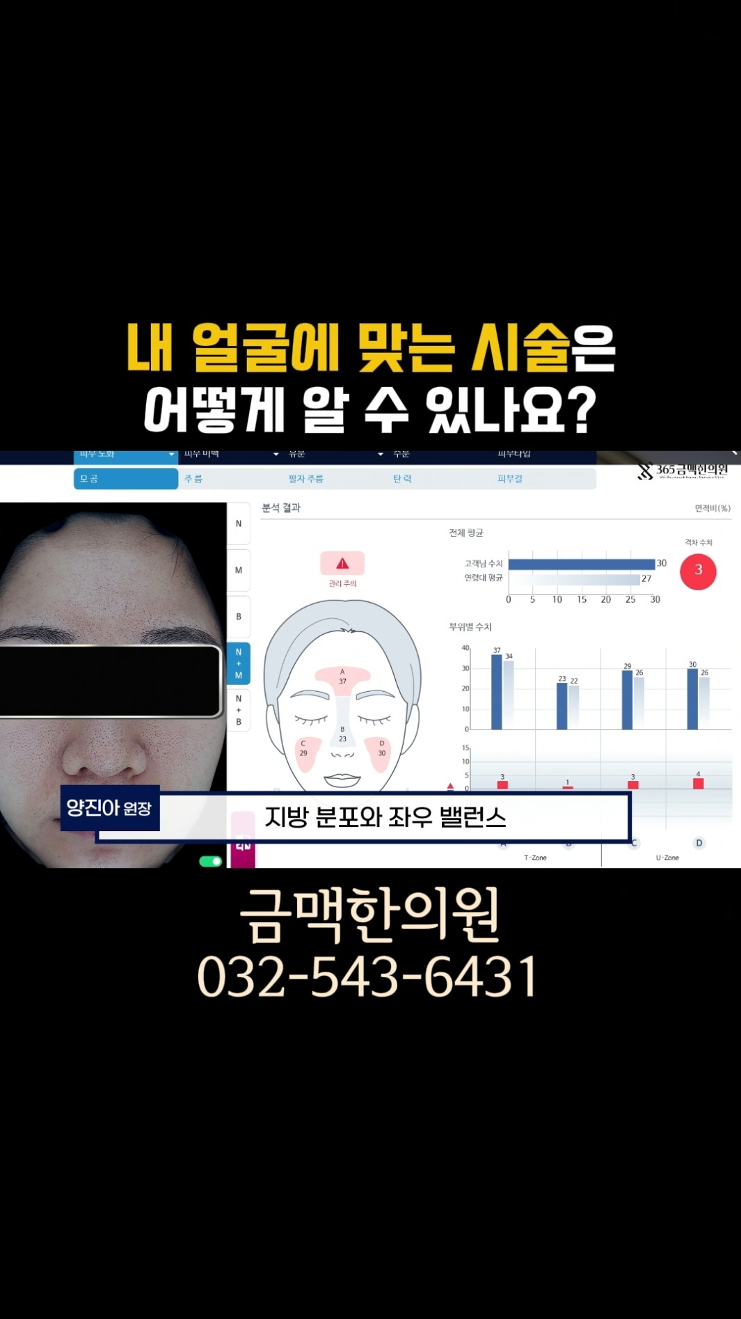 내 얼굴에 맞는 시술은 어떻게 아나요?