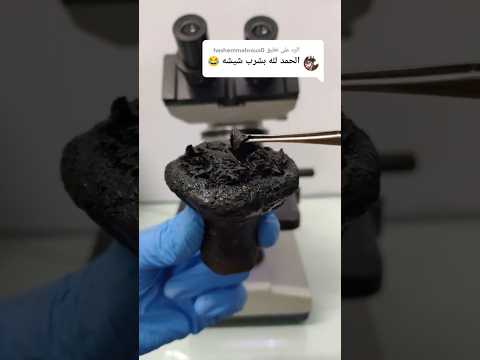 حجر الشيشة تحت الميكروسكوب  شيشه