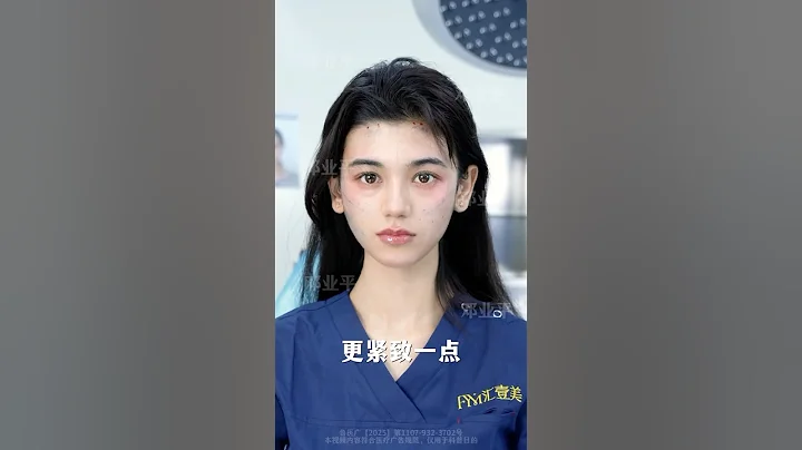 9D SMAS Ascension doesn't make you become someone else, it just makes you more natural and youthful