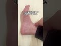 腰痛の人は…