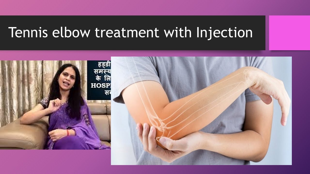 Tennis Elbow Treatment with Injections Guest Speaker Dr Kavita Dhania