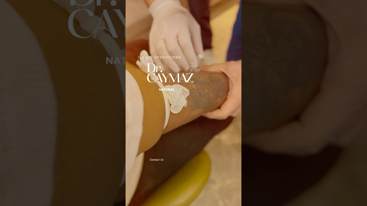 Hair Transplant in Istanbul