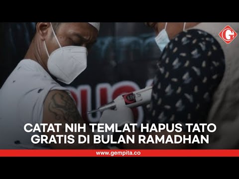 Hapus Tato Gratis Selama Bulan Ramadhan, Catat Nih Lokasinya