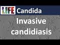 Invasive Candida