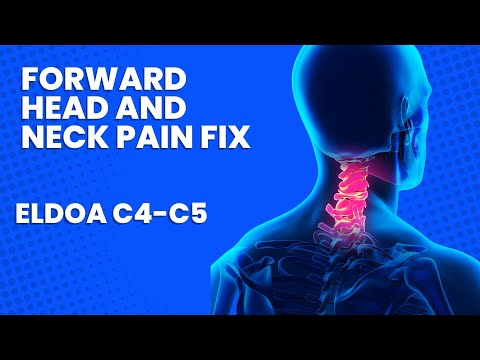 ELDOA C4-C5 How To