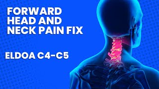 ELDOA C4-C5 How To
