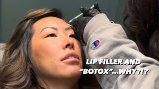 Lip Filler and &quot;Botox&quot;...