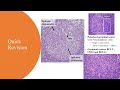 Approach To Diagnose 3 Lymph Node Diseases 