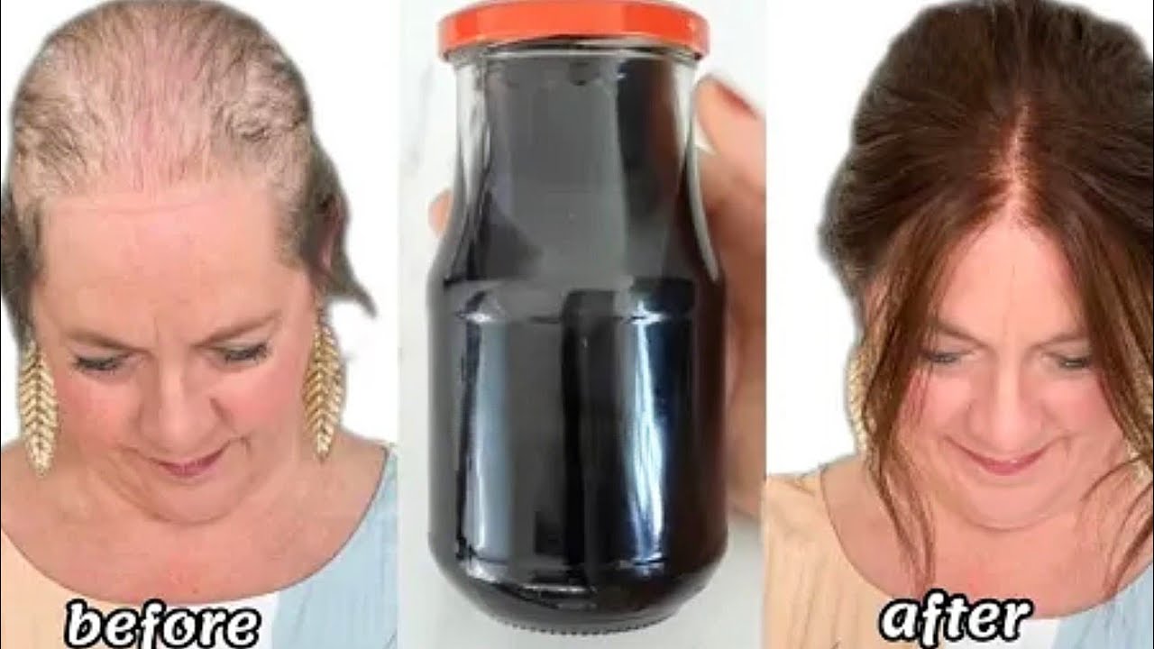 رشيه علي شعرك لمده يومين فقط ‼️هيخلي شعرك زي الباروكة ‼️تطويل وانبات ووقف التساقط 