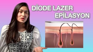 Lazer epilasyon nedir ? Diode Lazer epilasyon