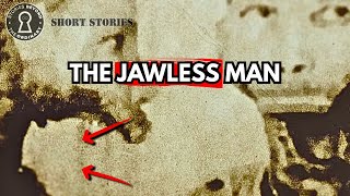 How a Champion Golfer Lost His Jaw: Eben Byers Story