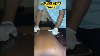 PARASPINAL MUSCLE RELEASE